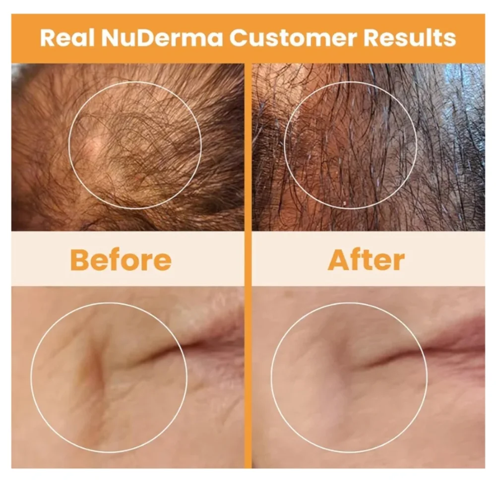 Pur NuDerma Skincare Tool Set AntiAging Tightening Dark Circles - Picture 5 of 7